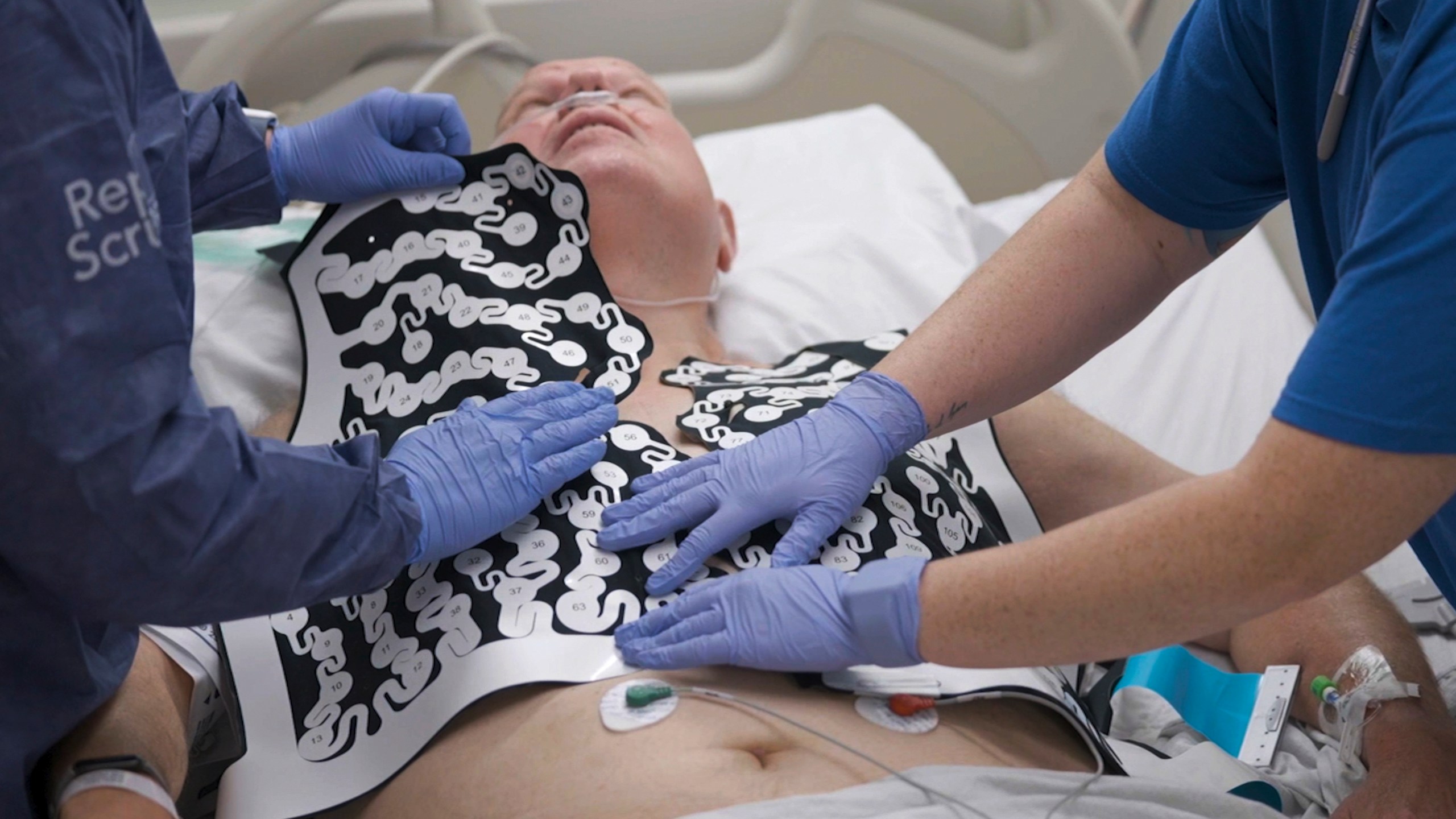 In this photo provided by Washington University, Jeff Backus is fitted with a vest of electrodes in St. Louis on Tuesday, Feb. 7, 2023, to map how his heartbeat goes awry. Doctors are zapping the heart with radiation normally reserved for cancer, a bid to better treat people with life-threatening irregular heartbeats who've exhausted other options. (Huy Mach/Washington University, St. Louis via AP)