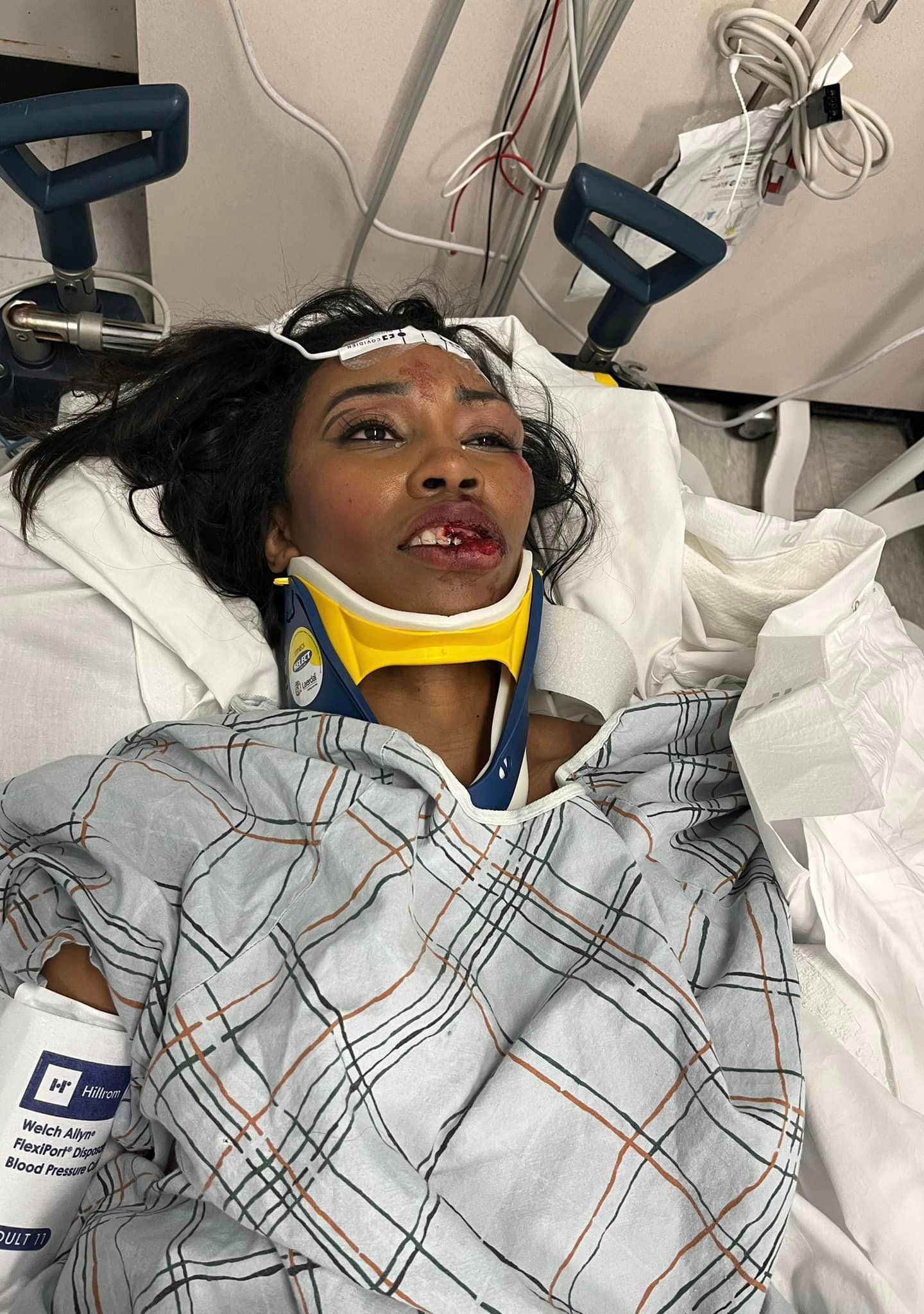 Memphis Color Purple actress Carrie Bernans recovering after being pinned under a bus in hit and run