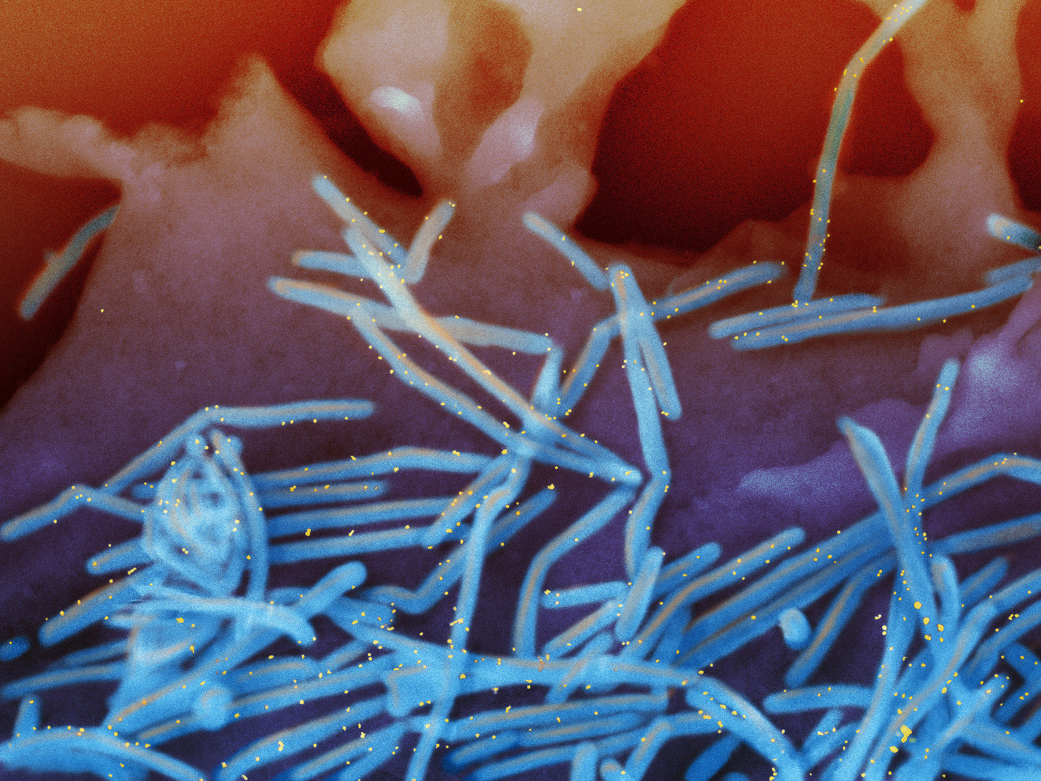 FILE - This electron microscope image provided by the National Institutes of Health shows human respiratory syncytial virus (RSV) virions, colorized blue, and anti-RSV F protein/gold antibodies, colorized yellow, shedding from the surface of human lung cells. (National Institute of Allergy and Infectious Diseases, NIH via AP, File)